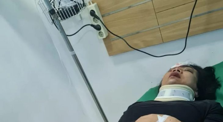 Kapolsek Medan Tuntungan Ditabrak Sepeda Motor Hingga Harus Dioperasi