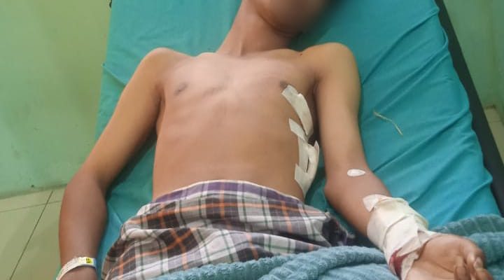 Tangan Anak Medan Nyaris Putus, Begal Bersenpi dan Bersajam Berkeliaran di Jalan Sultan Serdang