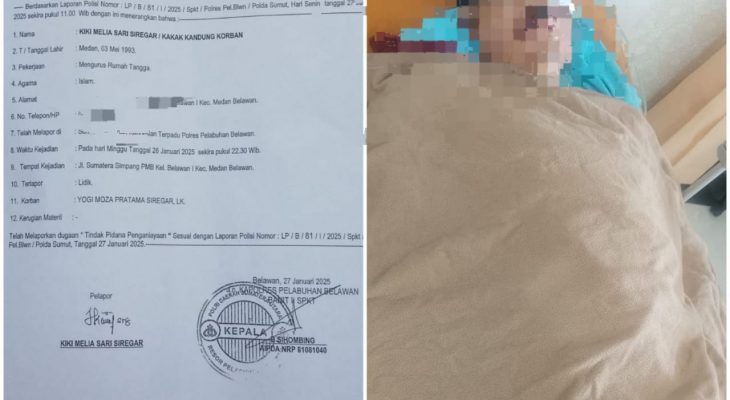 Pulang Kerja Dibacok Orang Tak Kenal, Kakak Korban : Mohon Keadilannya Untuk Adik Saya