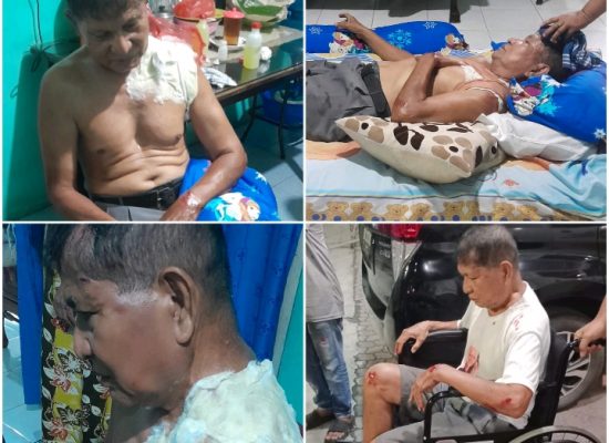 Medan Masih Rawan Begal, Loper Koran Nyaris Jadi Korban