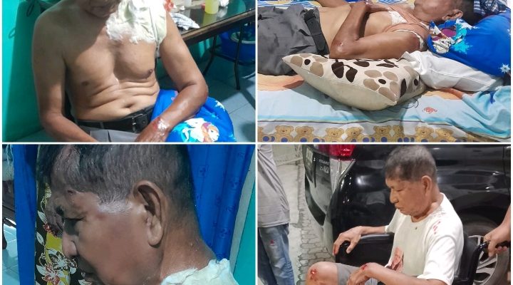 Medan Masih Rawan Begal, Loper Koran Nyaris Jadi Korban