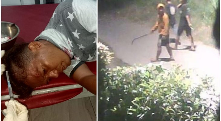 Dirampok 6 Pria Bersajam, Bocheri Terkapar Bersimbah Darah, Kapolsek Medan Labuhan Bungkam
