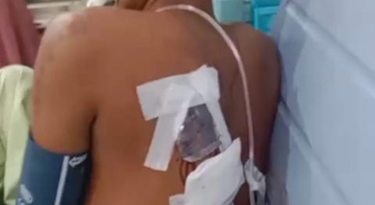 Warga Medan Nyaris Tewas Dibacok Begal di Hari HUT RI ke-80