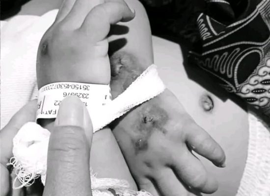Balita di Sidoarjo Meninggal Usai Ditolak Gunakan KIS, Keluarga Pertanyakan Layanan Klinik